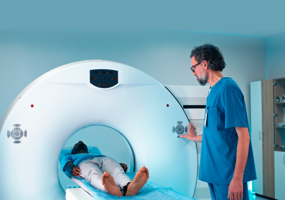 Role of PSMA PET Scan in Prostate Cancer Diagnosis