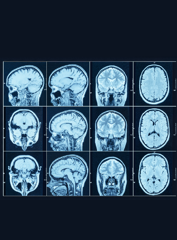 About PET-CT Scan